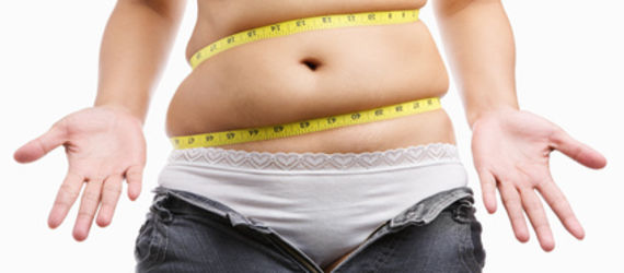 Bandáž žaludku – řešení nadváhy jen pro vyvolené